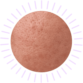 Skin test, che tipo di pelle hai? scopri il tuo tipo di pelle, per pelle grassa