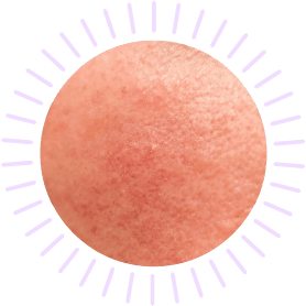 Skin test, che tipo di pelle hai? scopri il tuo tipo di pelle, rimedi pelle sensibile
