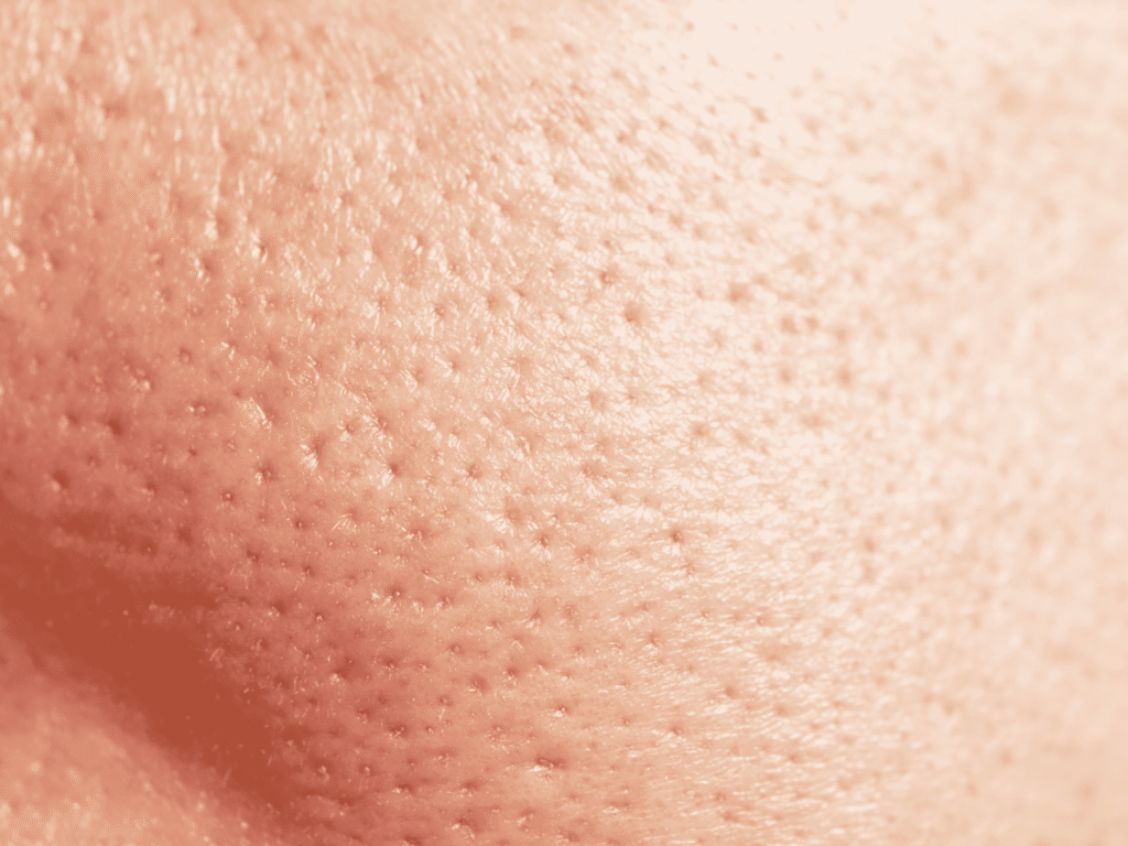 Protocollo per pelle asfittica skincare per pelli impure