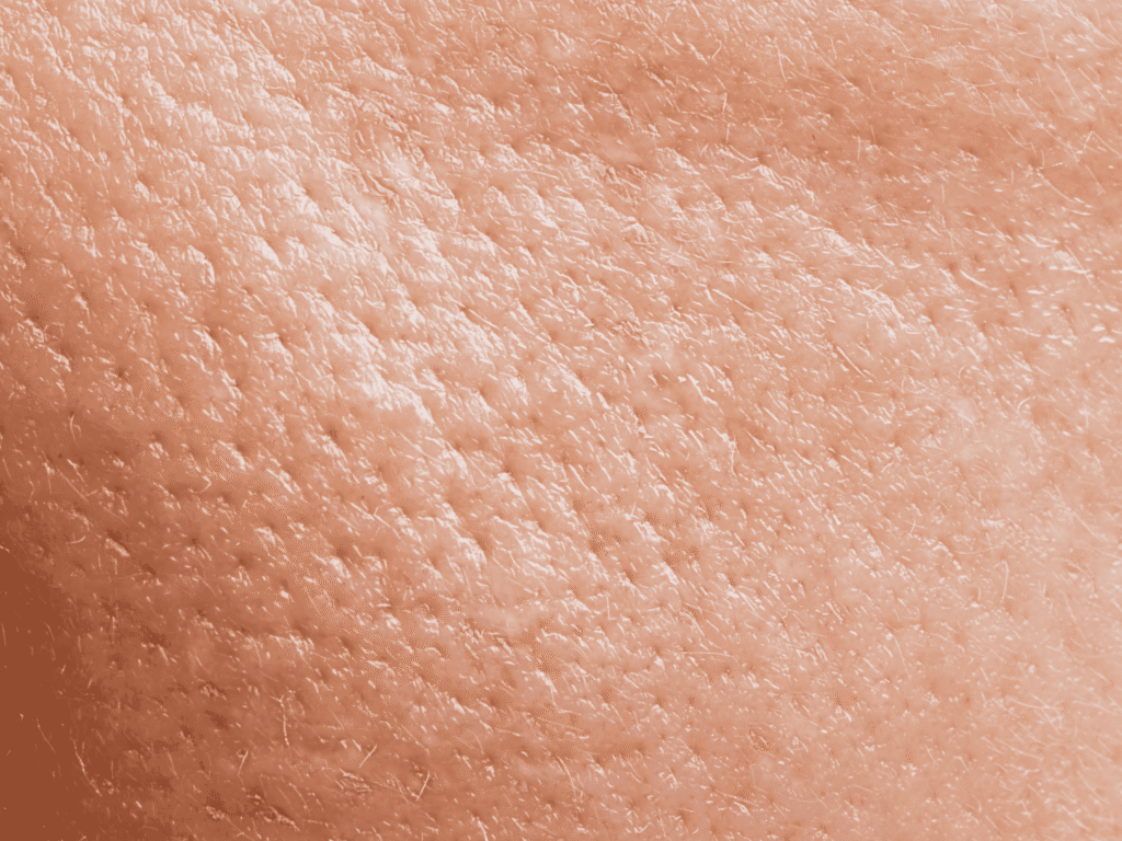 Protocollo per pelle grassa skincare per pelli grasse