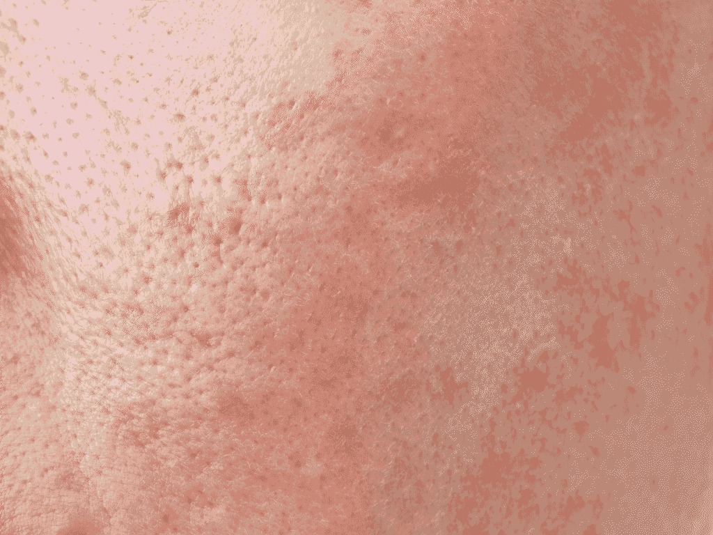 Protocollo per pelle mista skincare per pelli miste