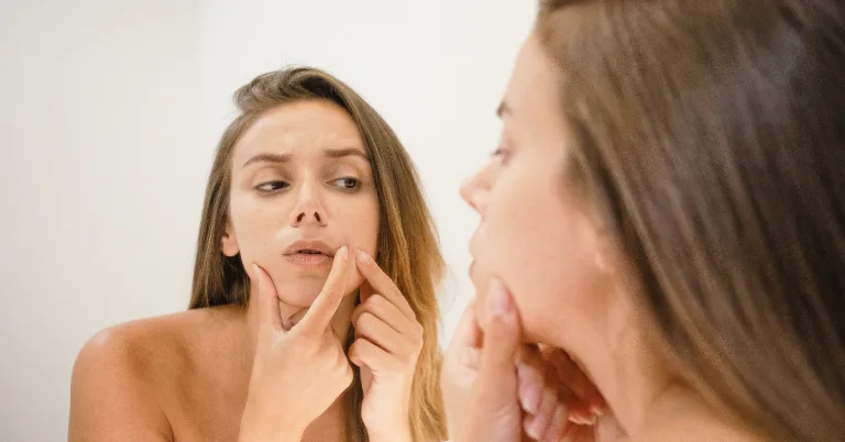 schiacciare i brufoli brufoli sottopelle macchie post brufoli come eliminarle